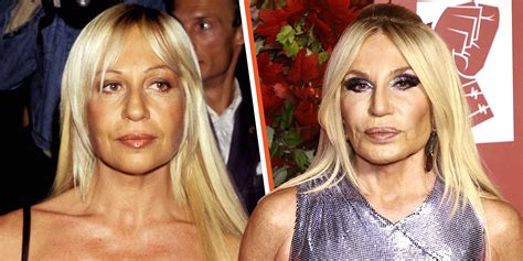 donatella versace before surgery|donatella versace facelift.